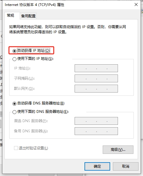 勾选自动获得IP地址 勾选自动获得IP地址